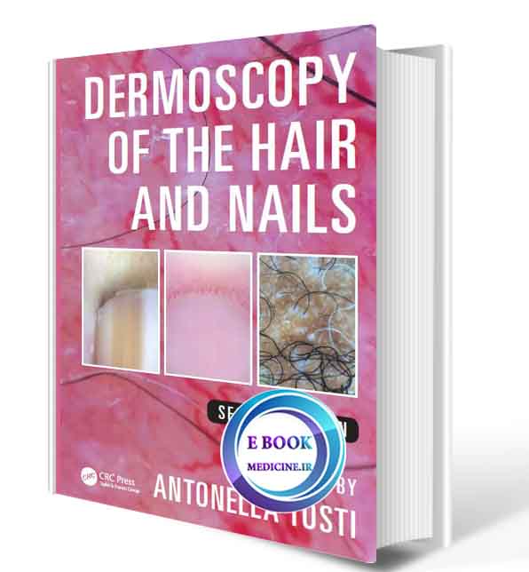 دانلود کتاب Dermoscopy of the Hair and Nails2017 (ORIGINAL PDF)